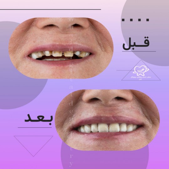 تصویر